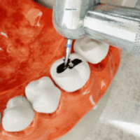 simdent-dental-training-simulator-zatnav-3-300x167